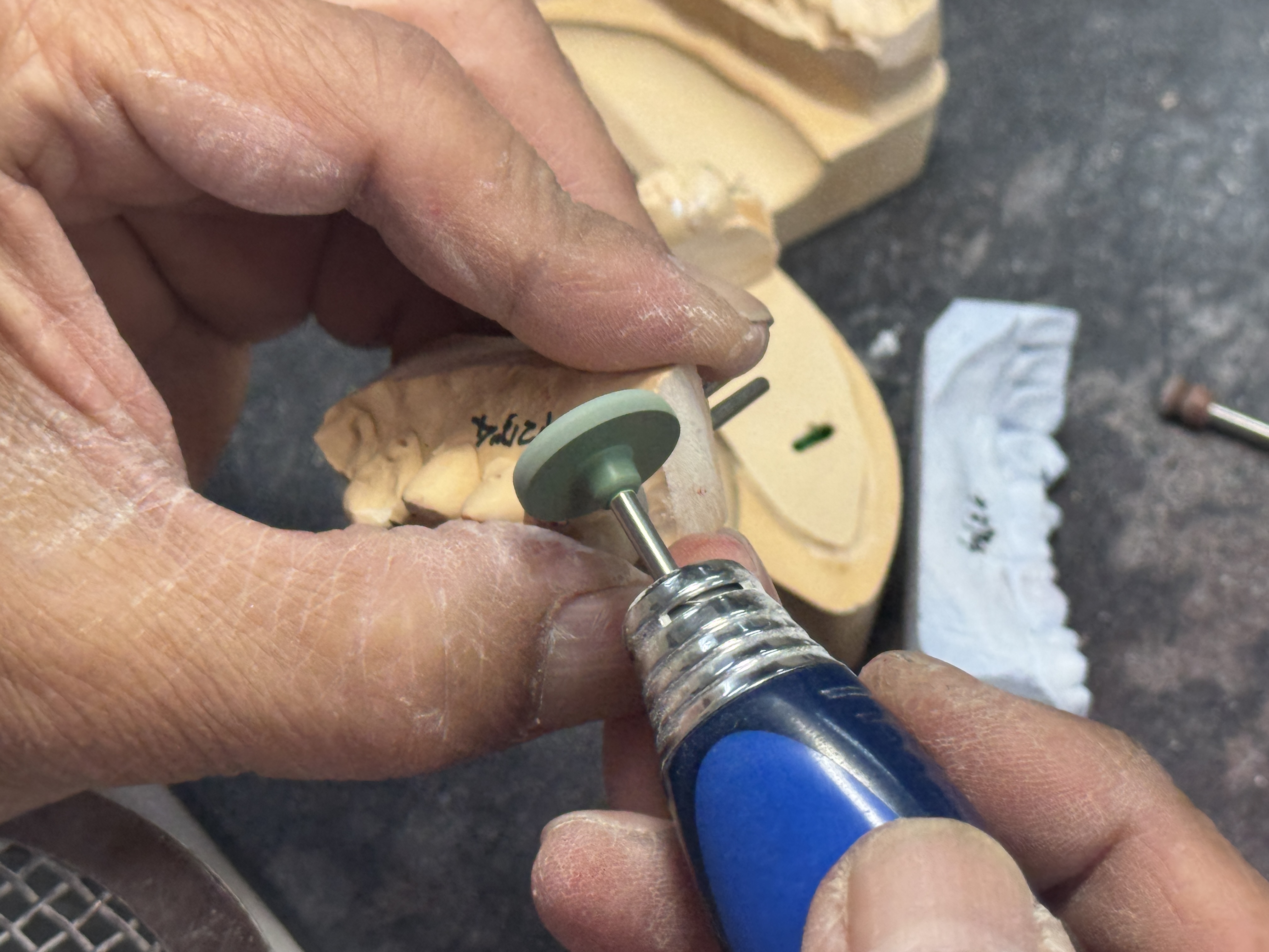 製作中の技工物
